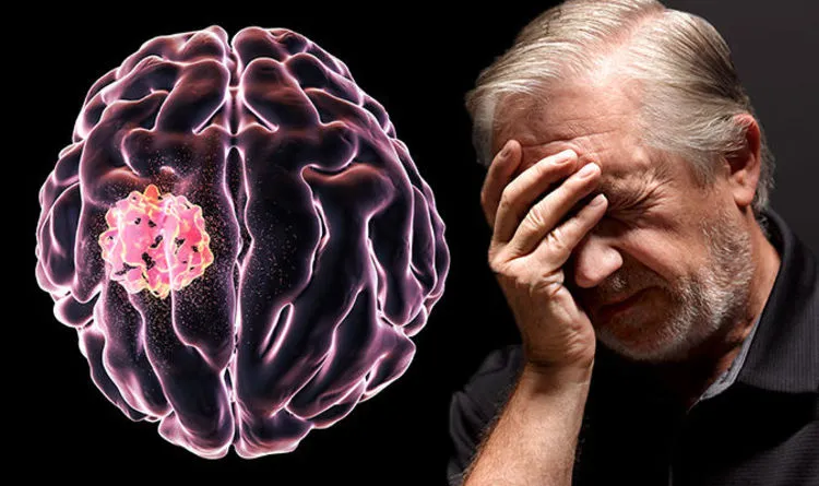 9 Gejala Tumor Otak yang Harus Diwaspadai